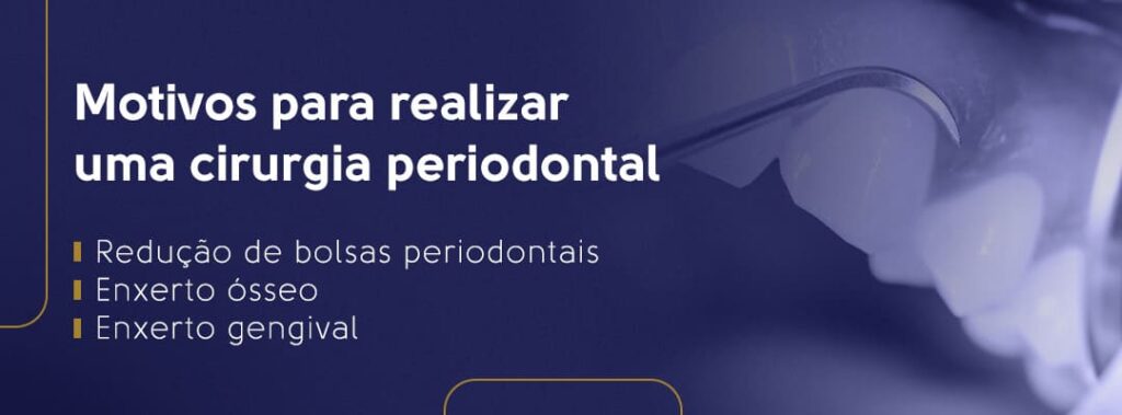 Motivos para realizar uma cirurgia periodontal: redução de bolsas periodontais, enxerto ósseo e enxerto gengival.