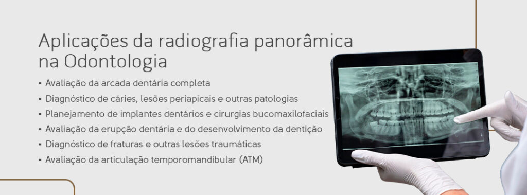 Aplicações da radiografia panorâmica na Odontologia: avaliação da arcada dentária completa,
diagnóstico de cáries, lesões periapicais e outras patologias,
planejamento de implantes dentários e cirurgias bucomaxilofaciais, avaliação da erupção dentária e do desenvolvimento da dentição,
diagnóstico de fraturas e outras lesões traumáticas e
avaliação da articulação temporomandibular (ATM).