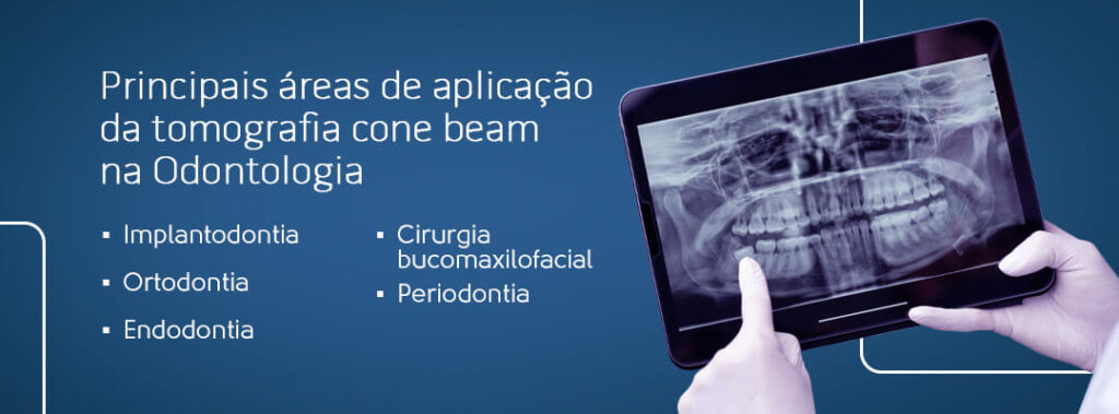 Principais áreas de aplicação da tomografia cone beam na Odontologia: implantodontia, ortodontia, endodontia, cirurgia bucomaxilofacial e
periodontia.