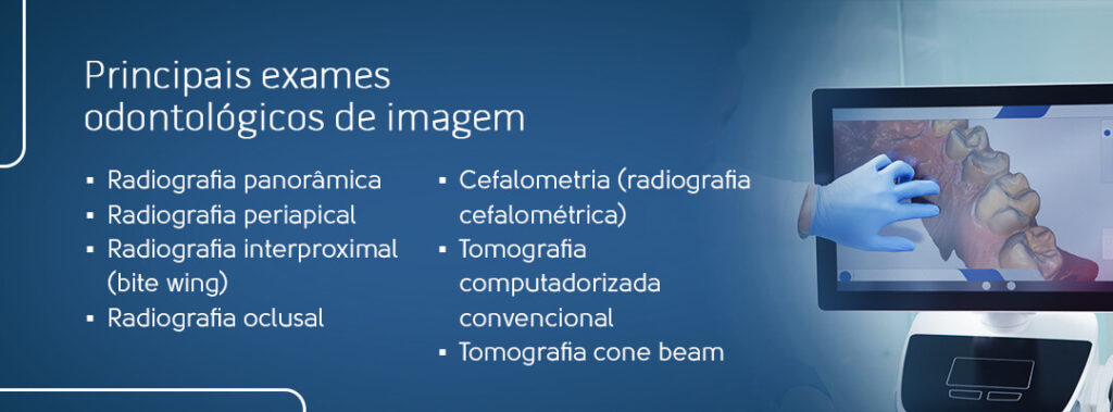 Principais exames odontológicos de imagem: Radiografia panorâmica, radiografia periapical, radiografia interproximal (bite wing), radiografia oclusal, cefalometria (radiografia cefalométrica), tomografia computadorizada convencional e tomografia cone beam.