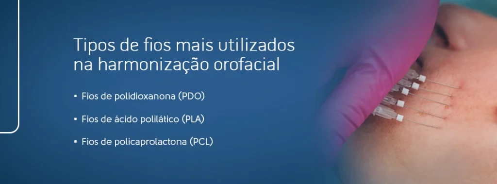 Imagem ilustrativa que apresenta os tipos de fios mais utilizados na harmonização orofacial, incluindo fios de polidioxanona (PDO), ácido polilático (PLA) e policaprolactona (PCL).
