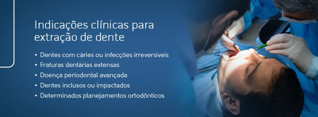 Indicações clínicas para extração de dente, como cáries, infecções, fraturas e planejamento ortodôntico.