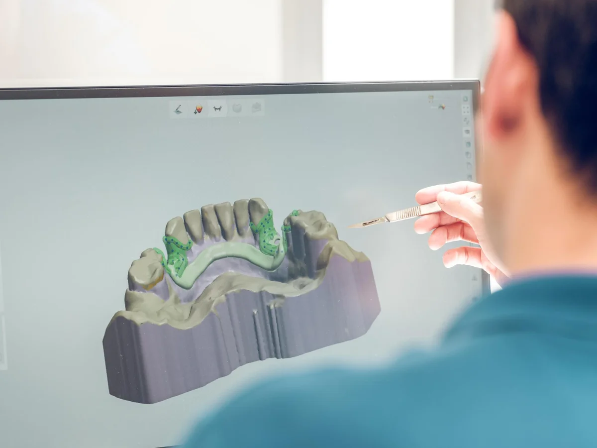 Profissional analisando modelo digital 3D de arcada dentária no computador para planejamento odontológico