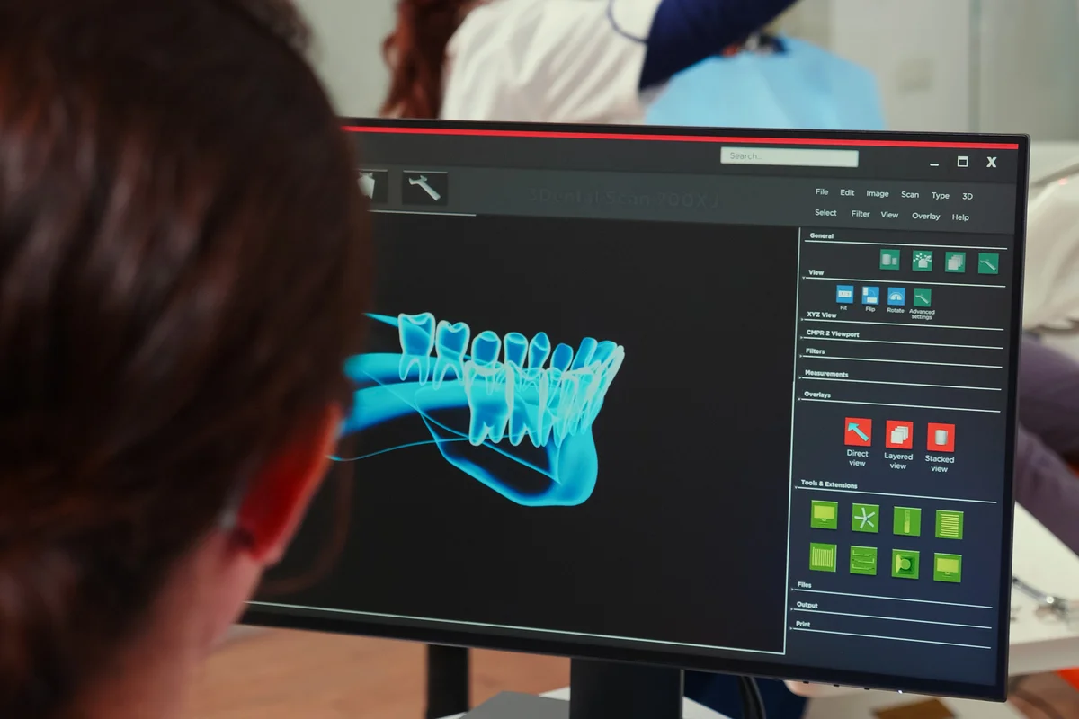 Escaneamento digital 3D da estrutura dos dentes da mandíbula inferior