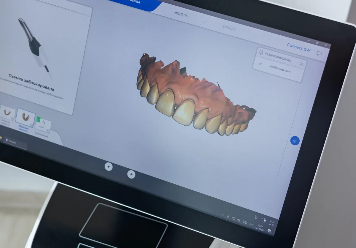 software de escaneamento dental 3D mostrando modelo digital de dentes superiores