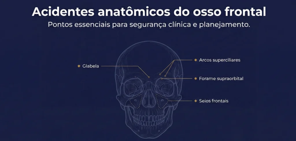 Esquema anatômico do osso frontal com pontos essenciais para segurança clínica e planejamento, incluindo glabela, arcossuperciliares e forame supraorbital
